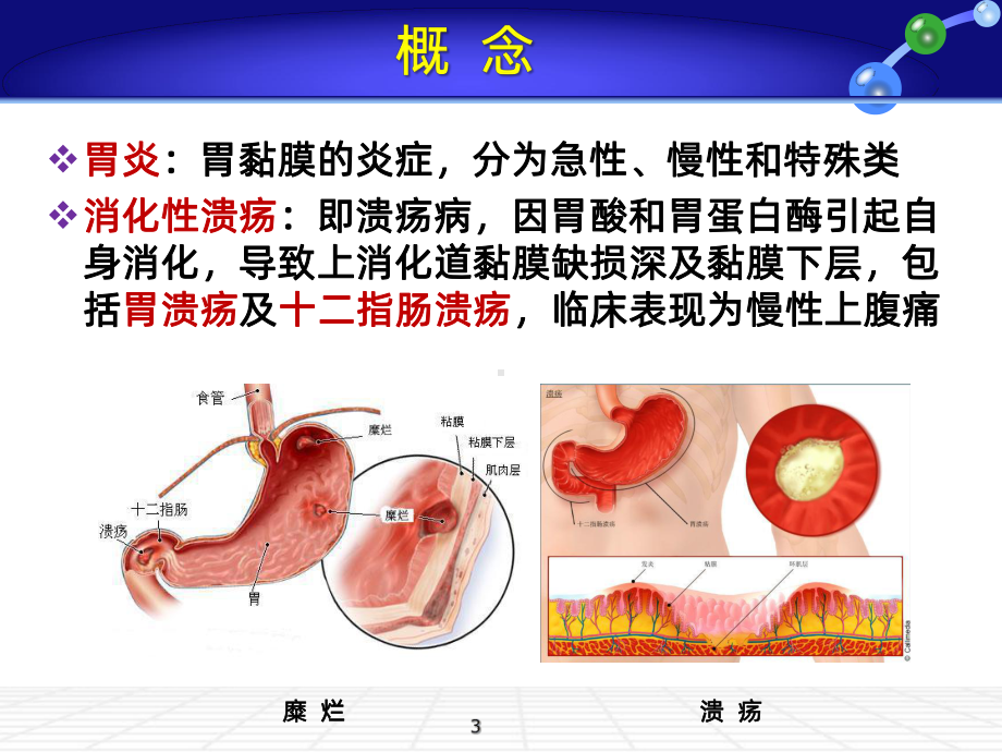 胃炎及PUPPT课件.ppt_第3页