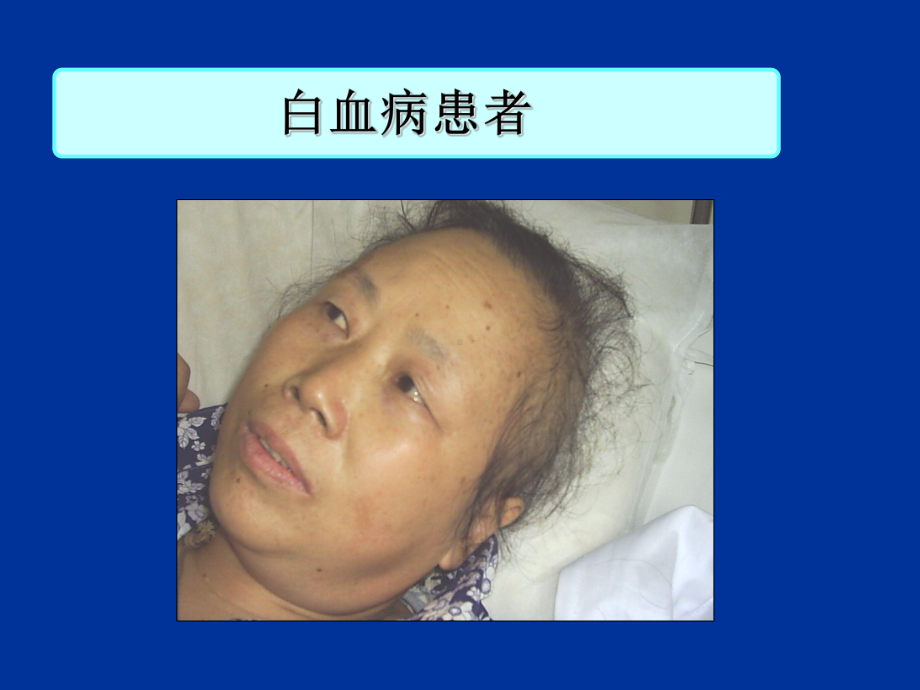 [基础医学]白血病总论课件.ppt_第3页