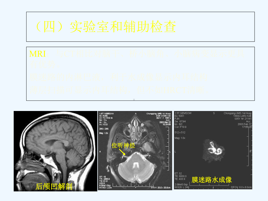 眩晕诊治新进展(二)课件.ppt_第2页