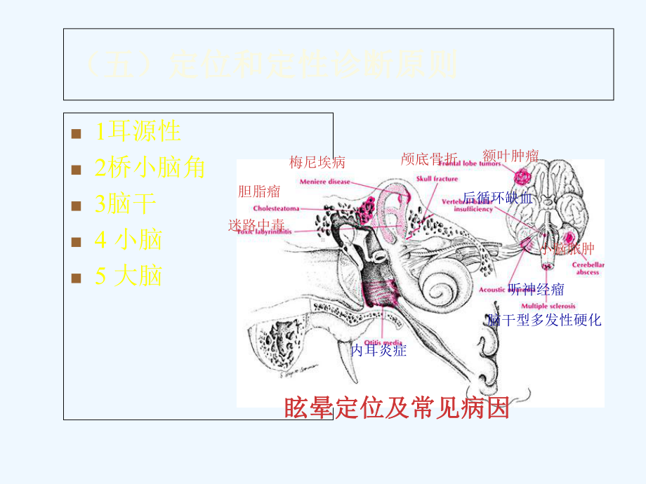 眩晕诊治新进展(二)课件.ppt_第3页