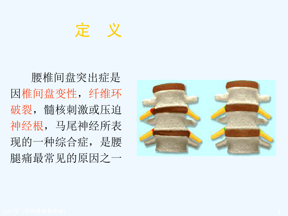 [推拿学]腰椎间盘突出课件.ppt_第2页