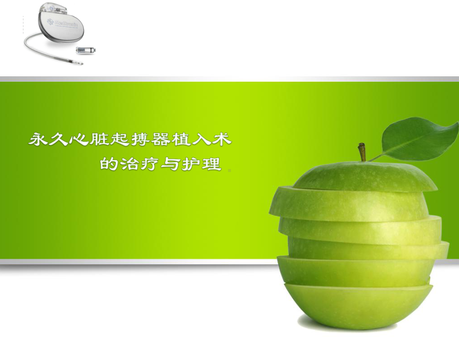 心脏起搏器的治疗护理课件.ppt_第1页