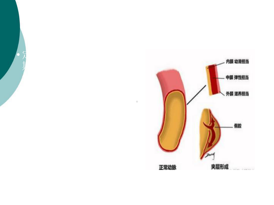 静脉炎的分级及处理1课件.ppt_第3页