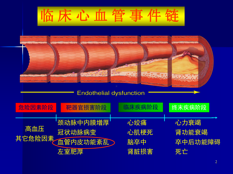 顽固性高血压ppt课件.ppt_第2页