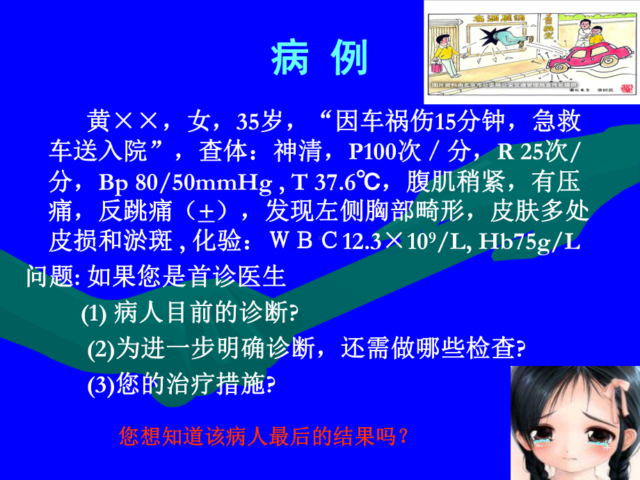 腹部损伤诊断及处理课件.pptx_第1页