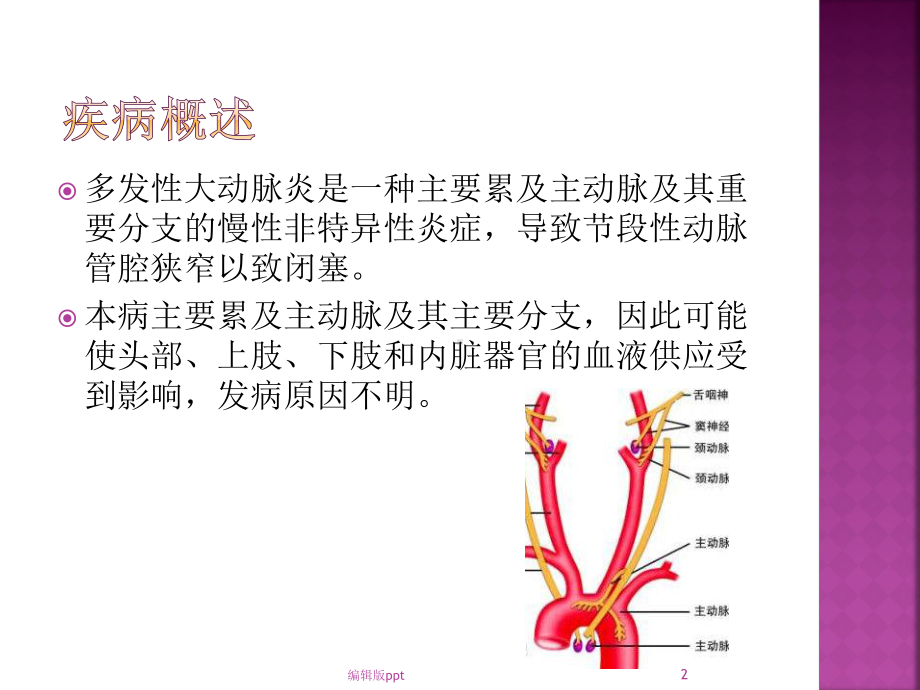 多发性大动脉炎医学PPT课件.pptx_第2页