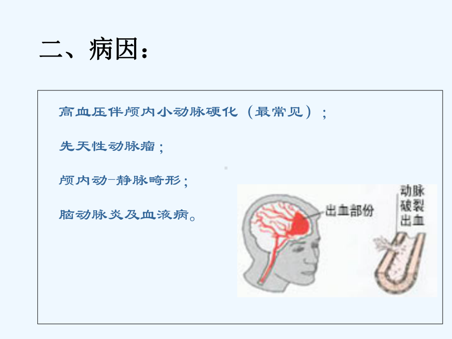 小讲课脑出血业务学习课件.ppt_第3页