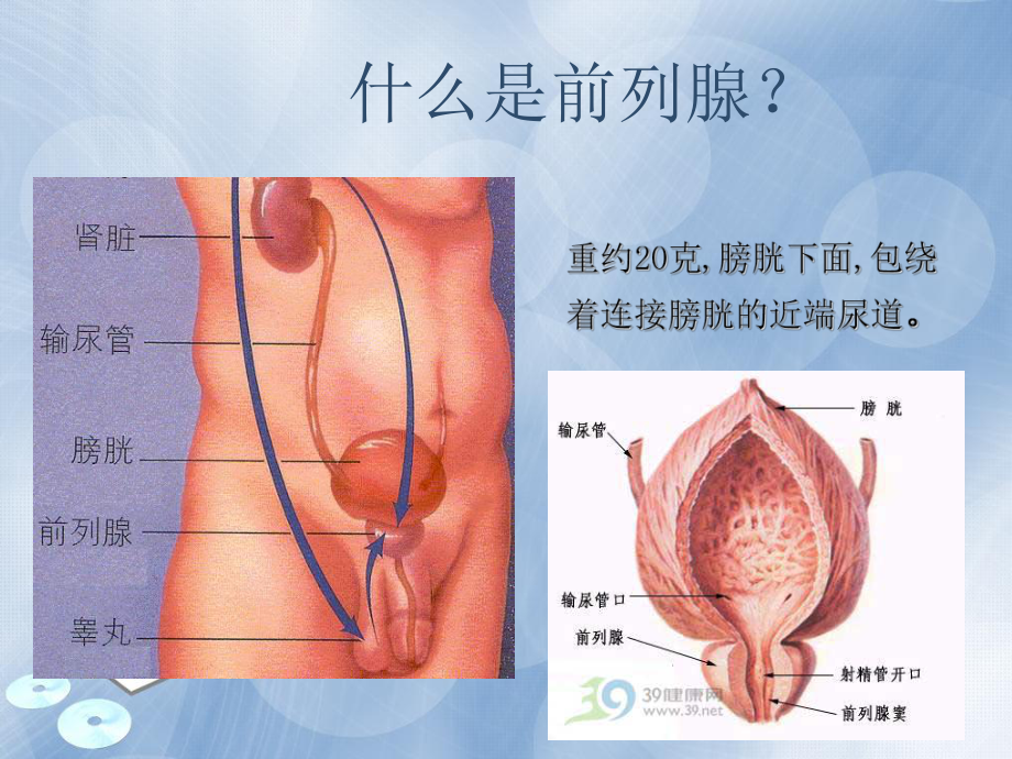 泌尿外科护理查房-前列腺增生课件.ppt_第3页