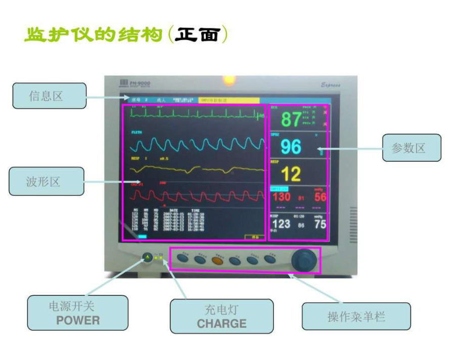 心电监护仪的使用-课件.ppt_第2页