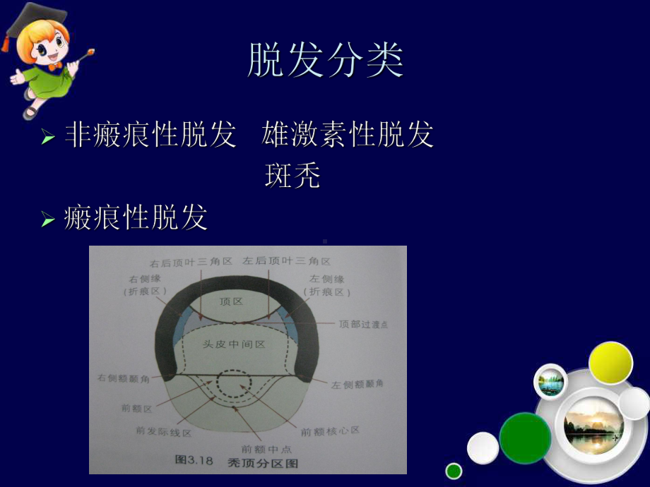 毛发移植ppt课件.ppt_第3页