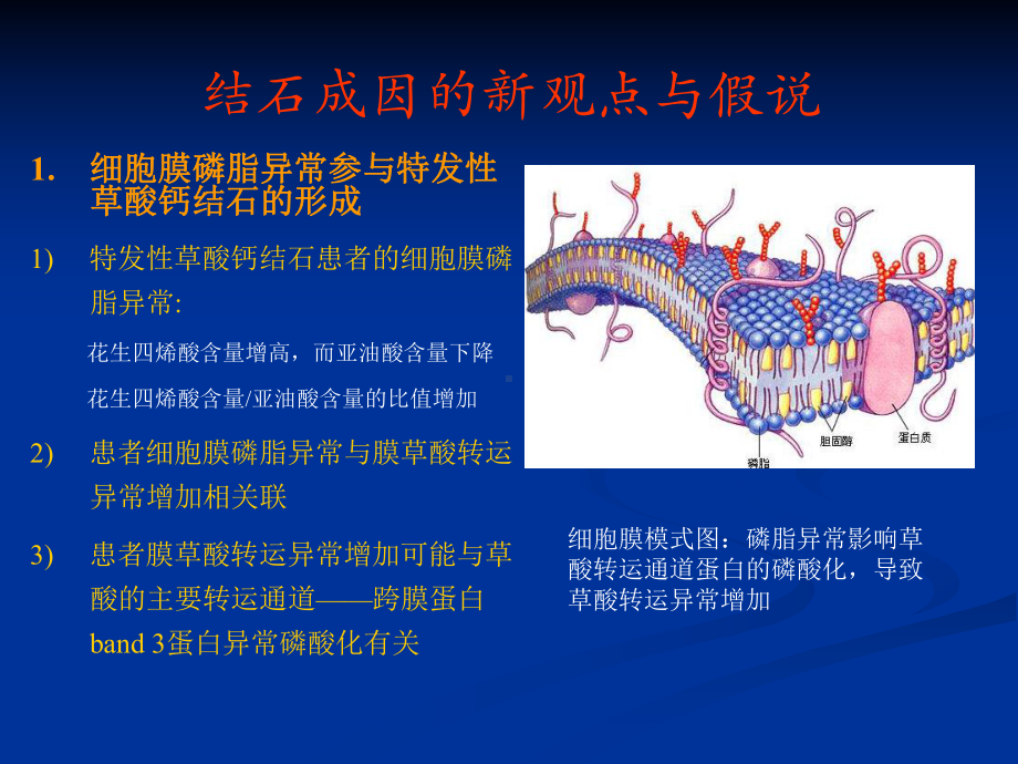 泌尿系结石防治的新进展课件.ppt_第2页