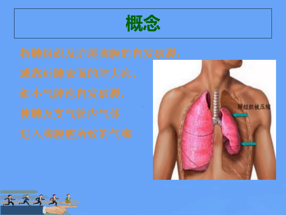 气胸护理查房2021优选课件.ppt_第3页