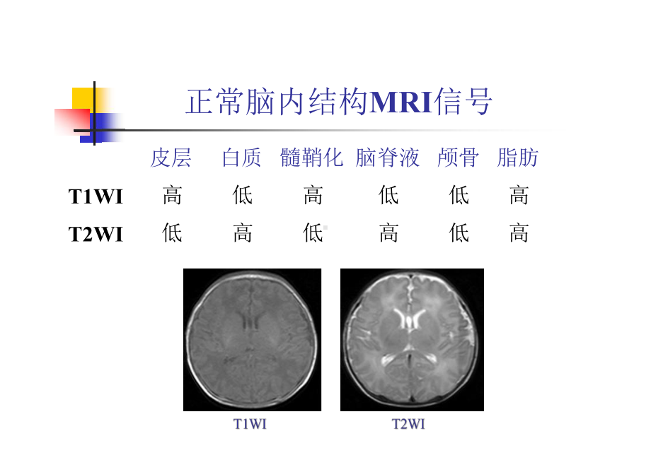 新生儿常见脑损伤磁共振成像课件.pptx_第3页