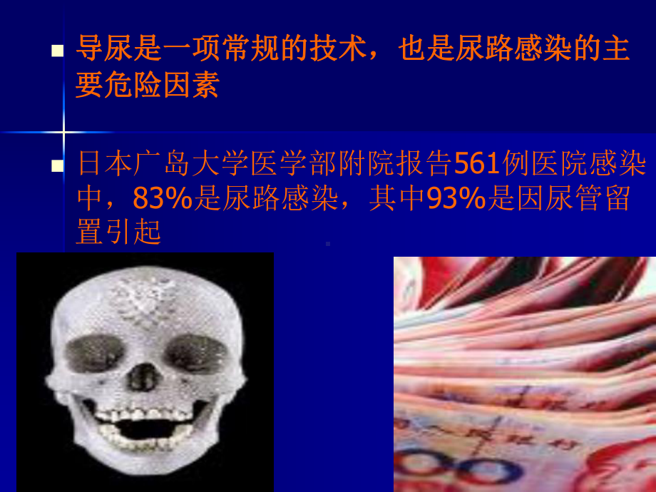 导尿与膀胱造瘘课件.ppt_第3页