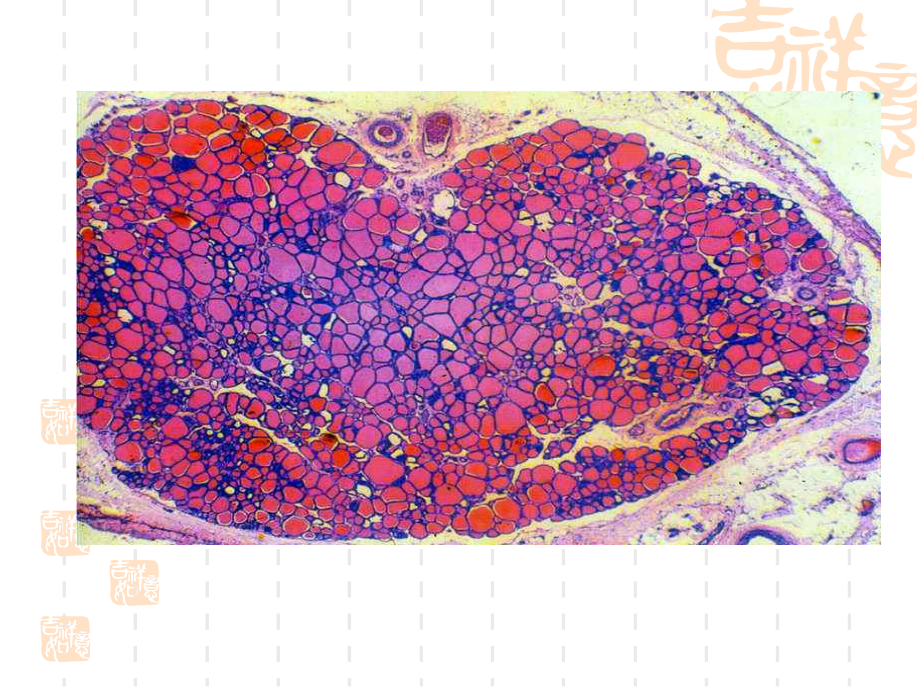 实验六内分泌腺眼球组织学与胚胎学实验课件.ppt_第3页