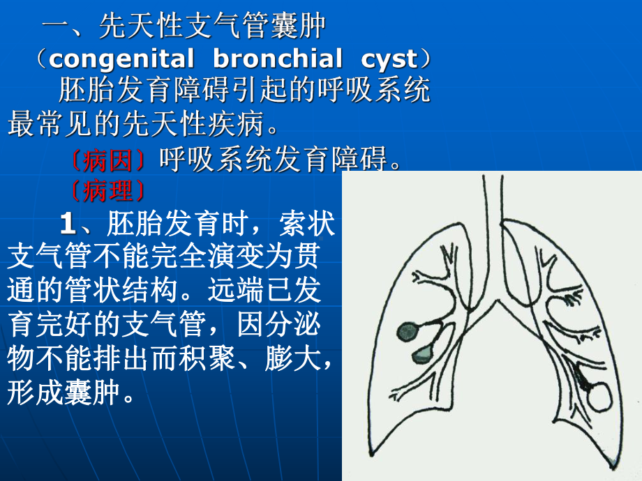 支气管囊肿及支气管扩张课件.ppt_第2页