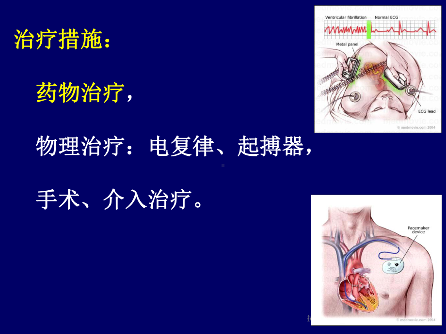 抗心律失常药[1]课件.ppt_第3页