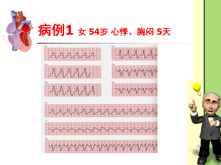 心律失常病例课件.ppt_第2页