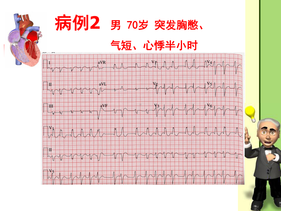 心律失常病例课件.ppt_第3页