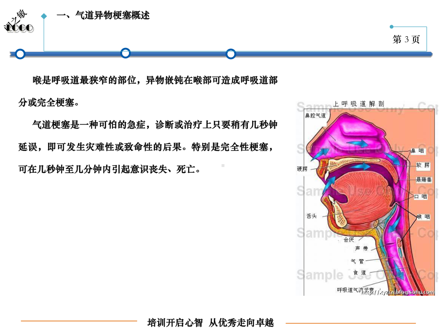 气道异物梗阻急救培训讲解课件.ppt_第3页