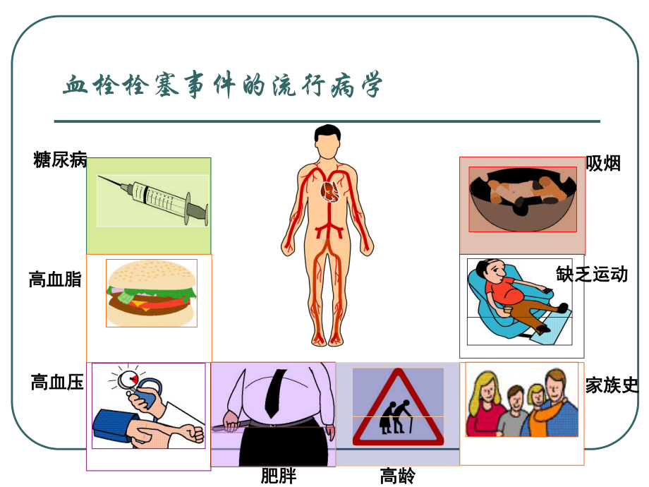 抗凝药物的发展(普通肝素戊糖)课件.ppt_第2页