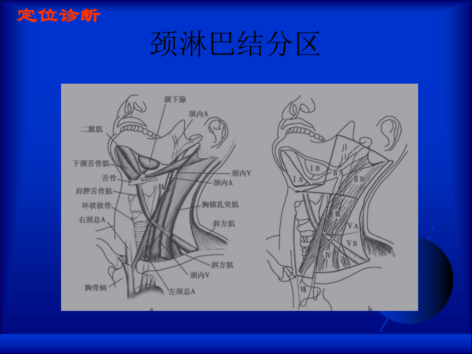 浅表淋巴结定位定性超声诊断精品课件.ppt_第3页