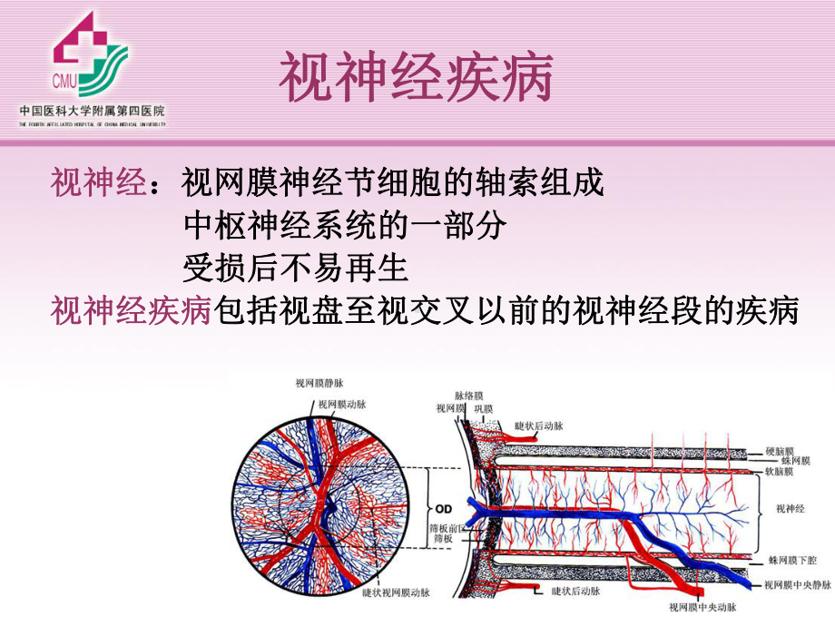 视神经及视路疾病学习培训模板课件.ppt_第2页