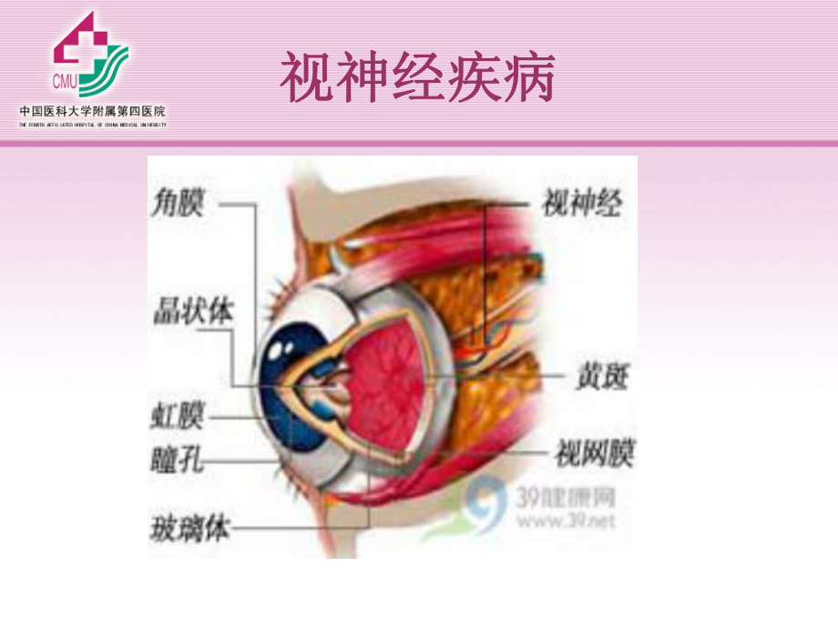 视神经及视路疾病学习培训模板课件.ppt_第3页