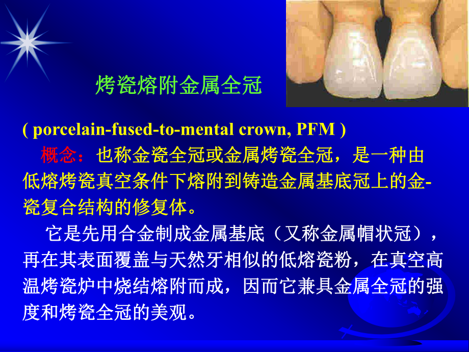 烤瓷熔附金属全冠课件.ppt_第1页