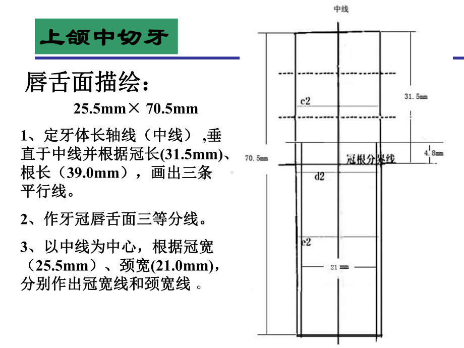 牙体形态描绘课件.ppt_第2页