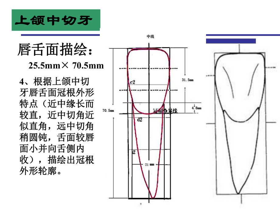 牙体形态描绘课件.ppt_第3页