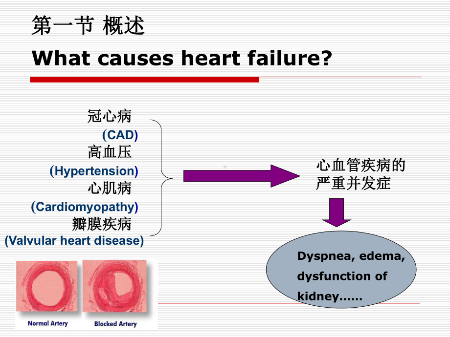 第十四章心力衰竭heartfailure-精品PPT课件PPT课件.ppt_第2页