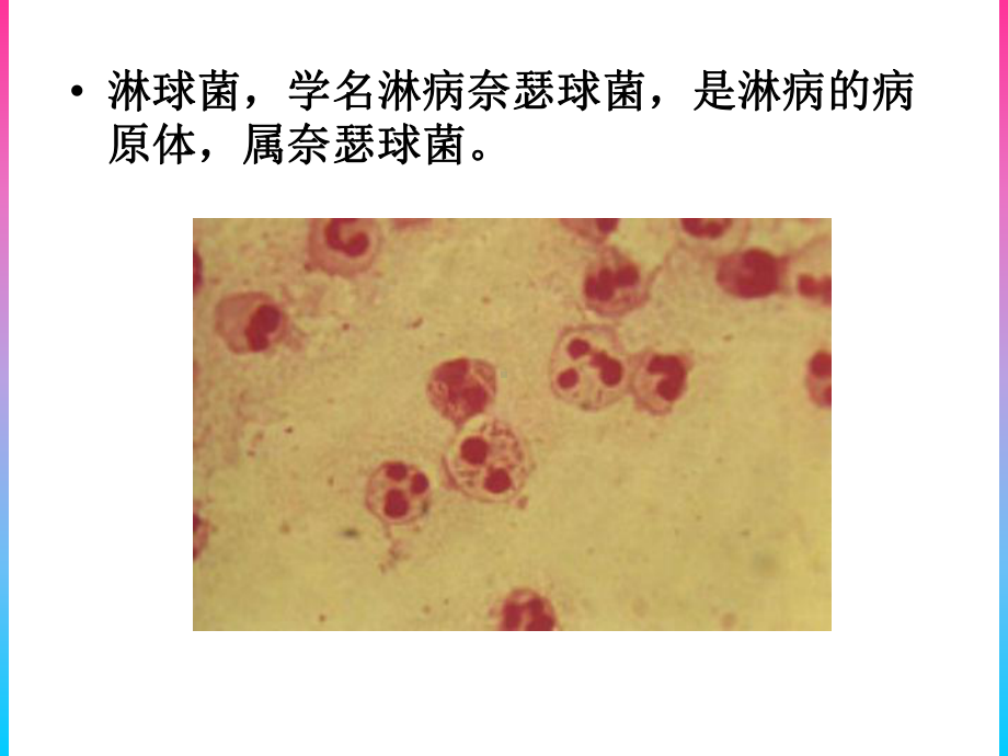 淋球菌适宜临床检验技术介绍课件.ppt_第3页