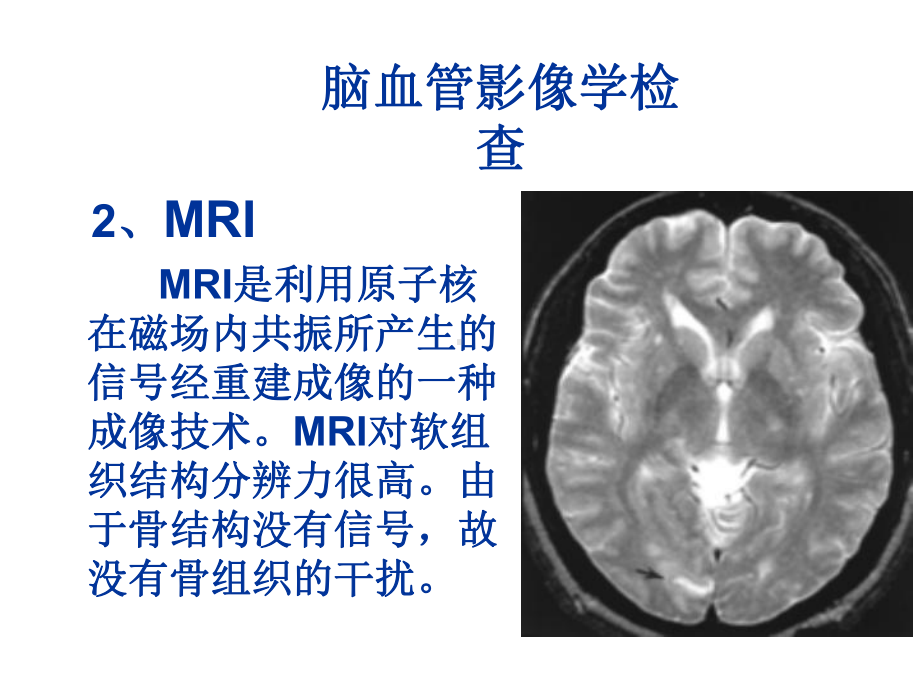 湘雅颅脑应用解剖6课件.ppt_第2页