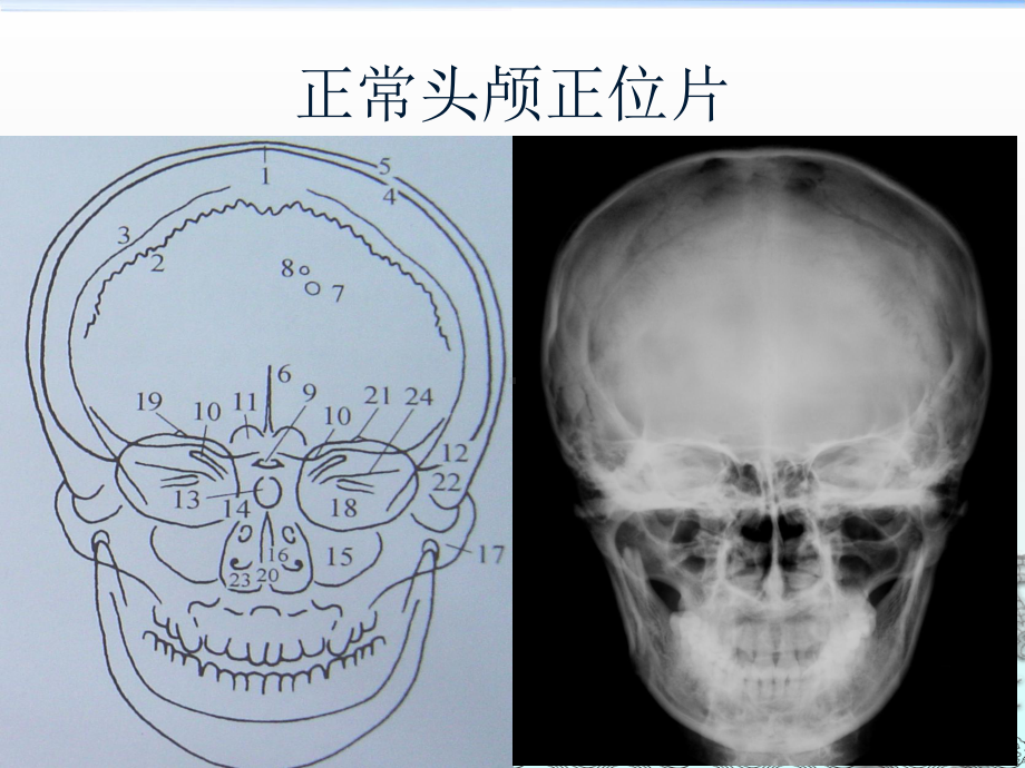 神经系统影像学诊断课件.ppt_第3页