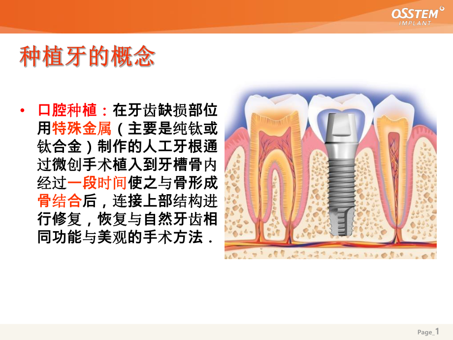 种植牙Osstem基础精选课件.ppt_第1页