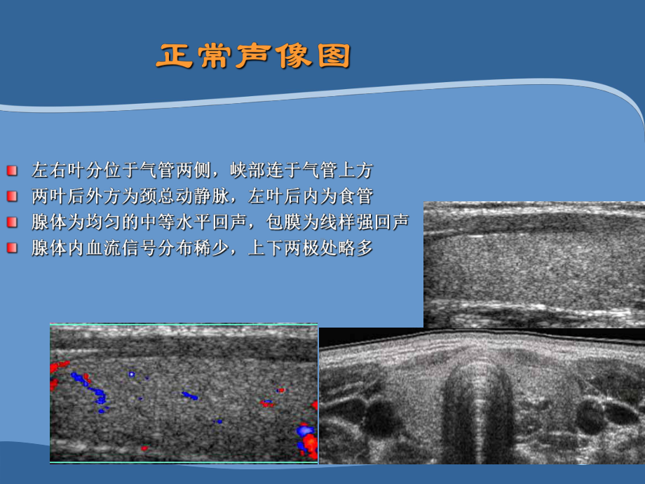 甲状腺超声诊断进展及介入治疗课件.ppt_第2页