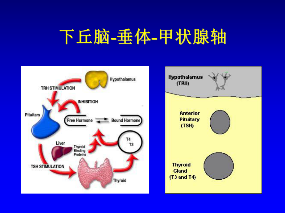 甲状腺机能亢进症(Hyperthyroidism)课件.ppt_第3页