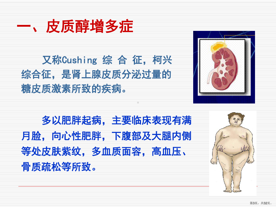 腺垂体肾上腺皮质课件.ppt_第3页