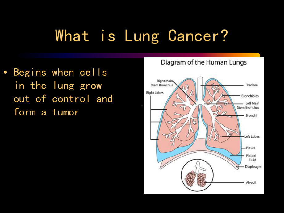 讲课肺癌英文课件.ppt_第2页