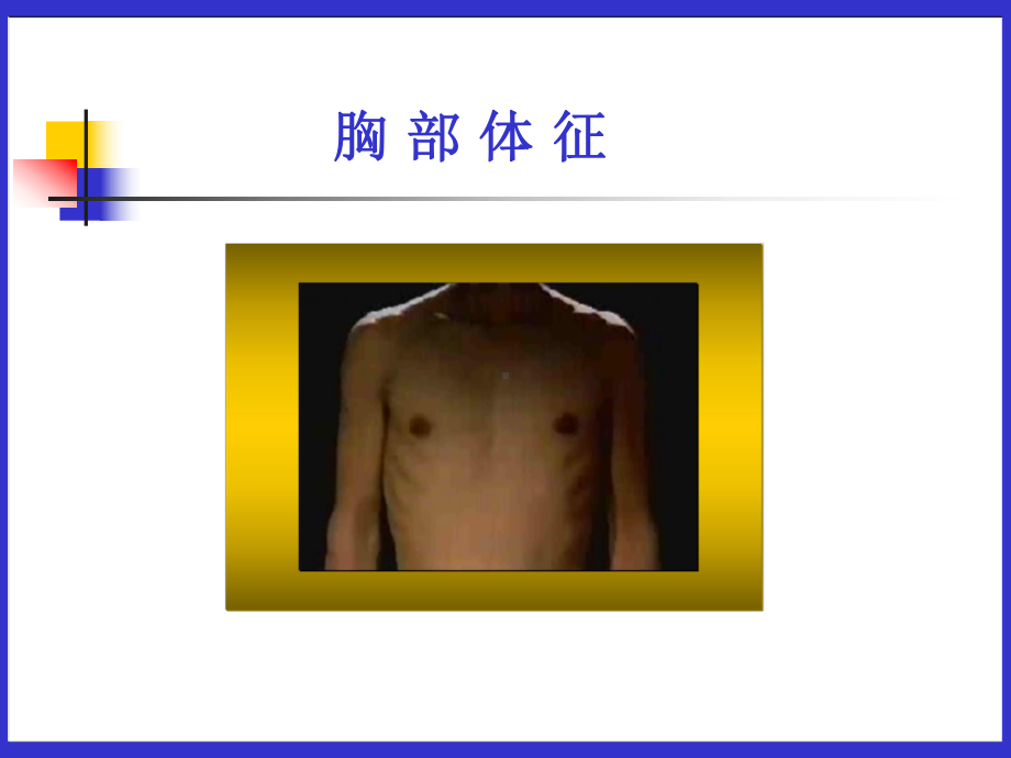 诊断学课件：胸部-理学检查.ppt_第2页