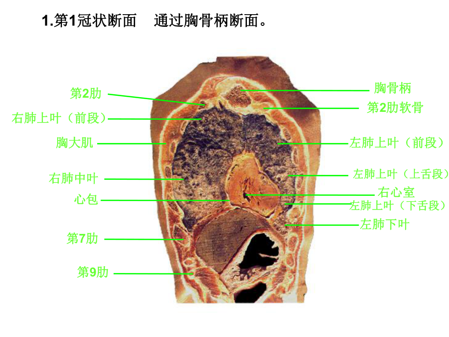 胸部冠矢状断面解剖与影像课件.ppt_第3页