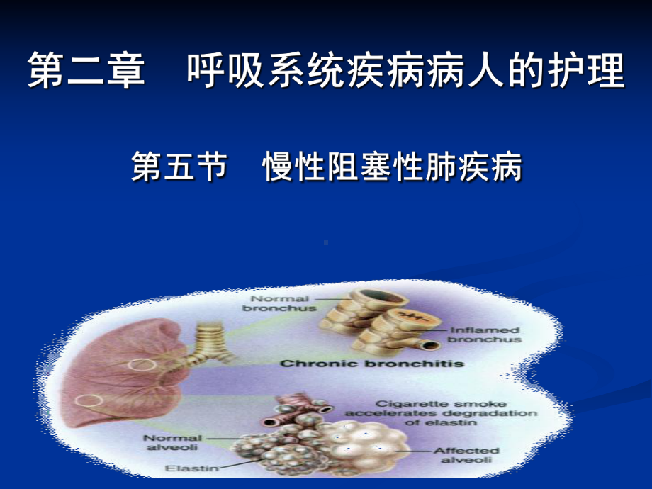 2慢性阻塞性肺疾病课件.ppt_第1页