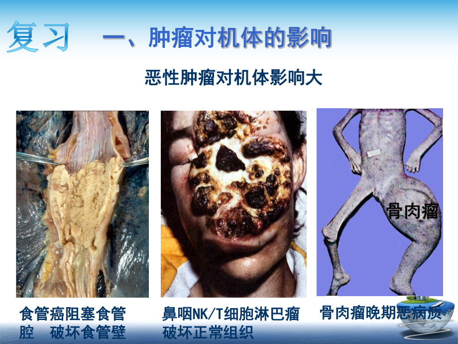 肿瘤(4病因学和发病学重要概念)课件.ppt_第2页