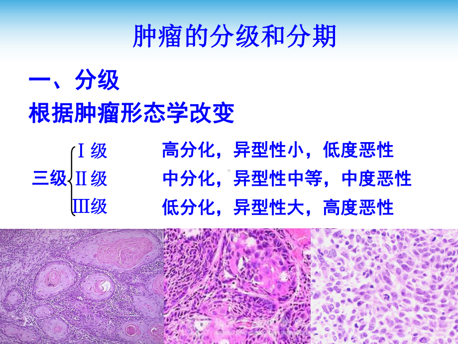 肿瘤(4病因学和发病学重要概念)课件.ppt_第3页