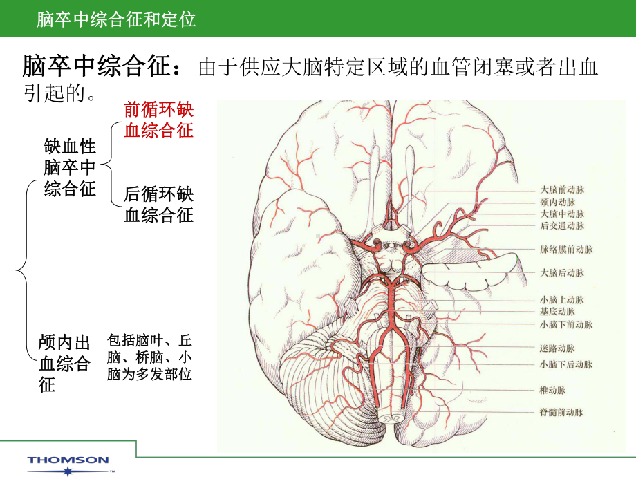 脑卒中综合症和定位课件.ppt_第2页