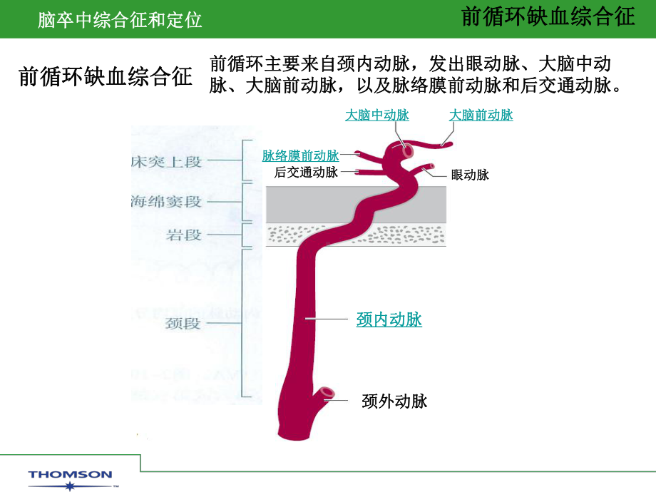 脑卒中综合症和定位课件.ppt_第3页