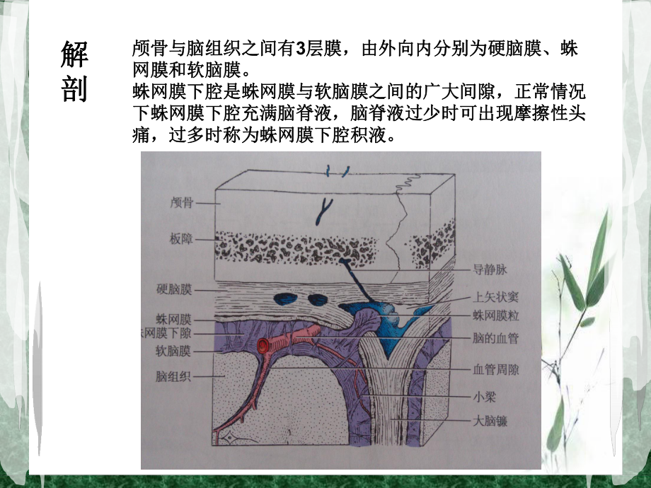 蛛网膜囊肿-PPT课件.ppt_第3页