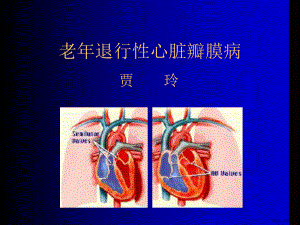 老年退行性心脏瓣膜病课件.ppt