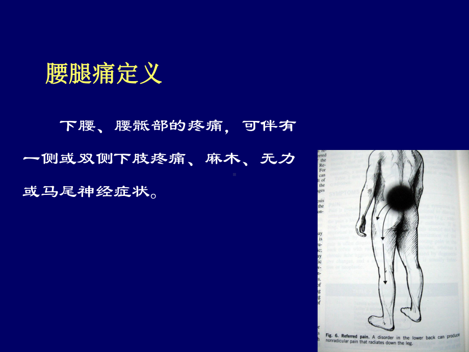 腰椎常见疾病的诊断与治疗课件.ppt_第2页